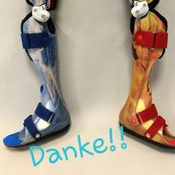 Zwei Ganzbein-Orthesen in blau und orange