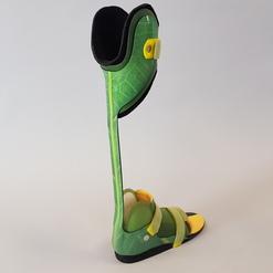 Unterschenkel-Orthese rechts mit Carbon-Feder